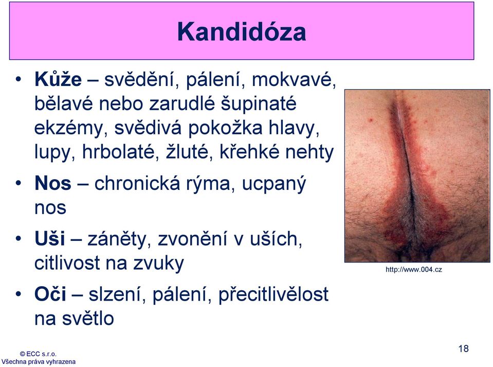 chronická rýma, ucpaný nos Uši záněty, zvonění v uších, citlivost na