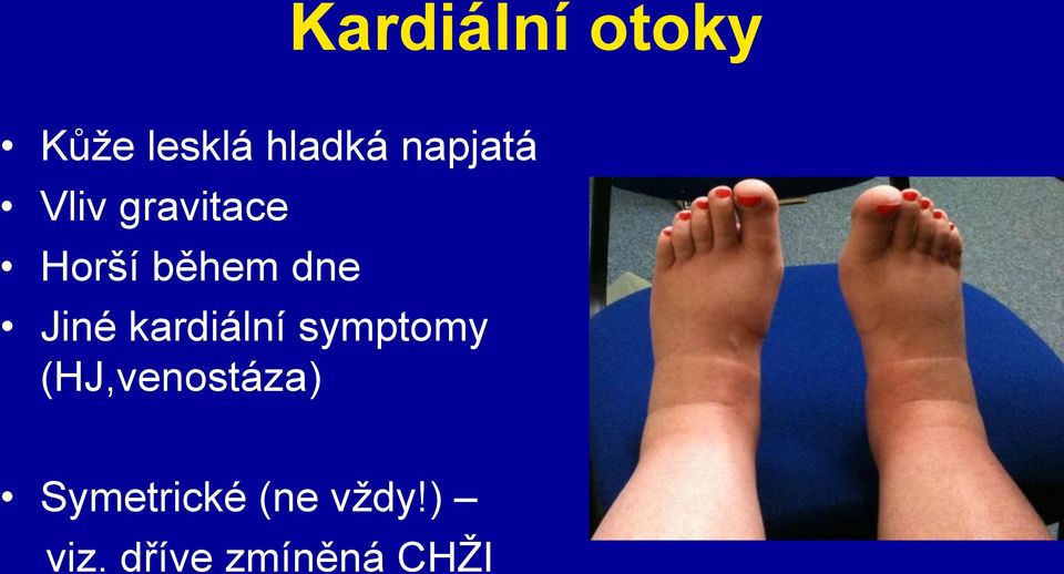 Jiné kardiální symptomy (HJ,venostáza)