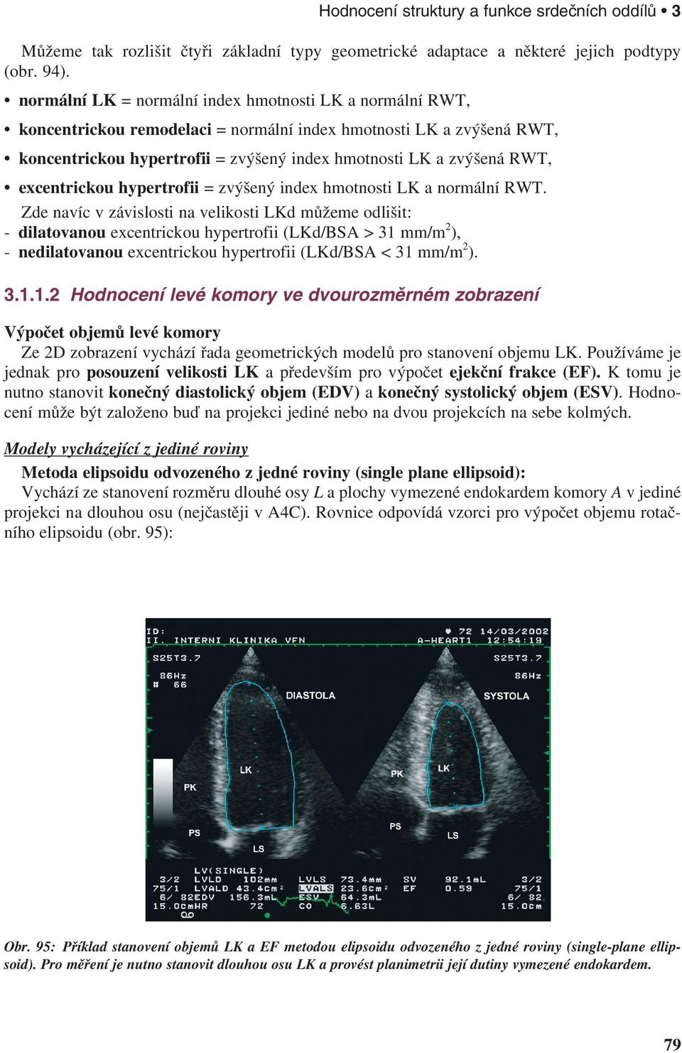 excentrickou hypertrofii = zvýšený index hmotnosti LK a normální RWT.