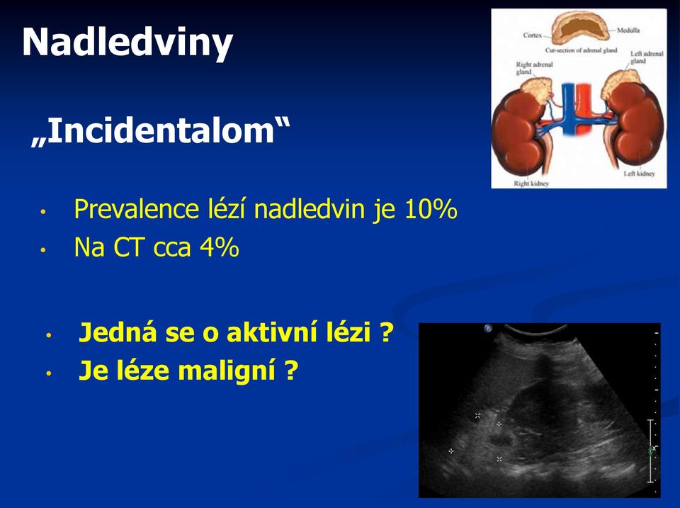 je 10% Na CT cca 4% Jedná