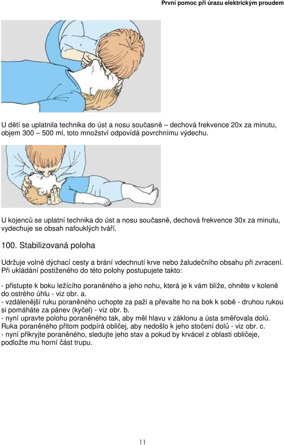 Stabilizovaná poloha Udržuje volné dýchací cesty a brání vdechnutí krve nebo žaludečního obsahu při zvracení.