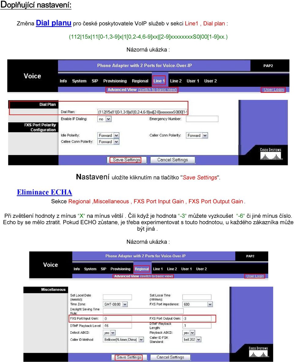 Sekce Regional,Miscellaneous, FXS Port Input Gain, FXS Port Output Gain. Při zvětšení hodnoty z mínus X na mínus větší.