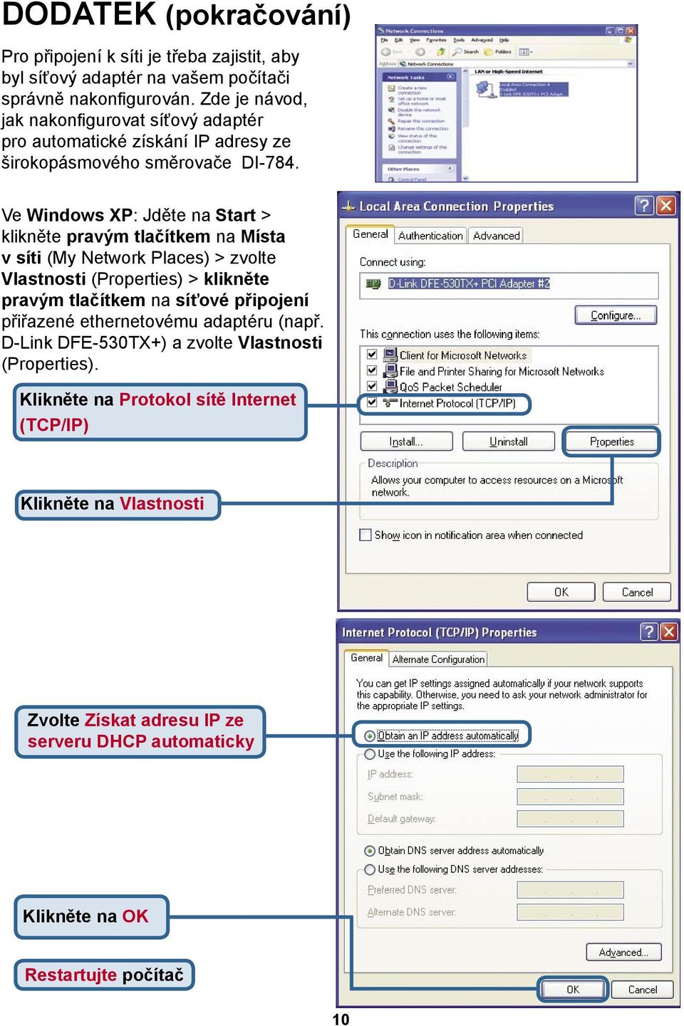 Ve Windows XP: Jděte na Start > klikněte pravým tlačítkem na Místa v síti (My Network Places) > zvolte Vlastnosti (Properties) > klikněte pravým tlačítkem na síťové
