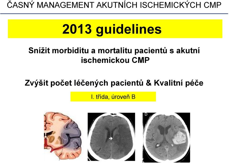 ischemickou CMP Zvýšit počet