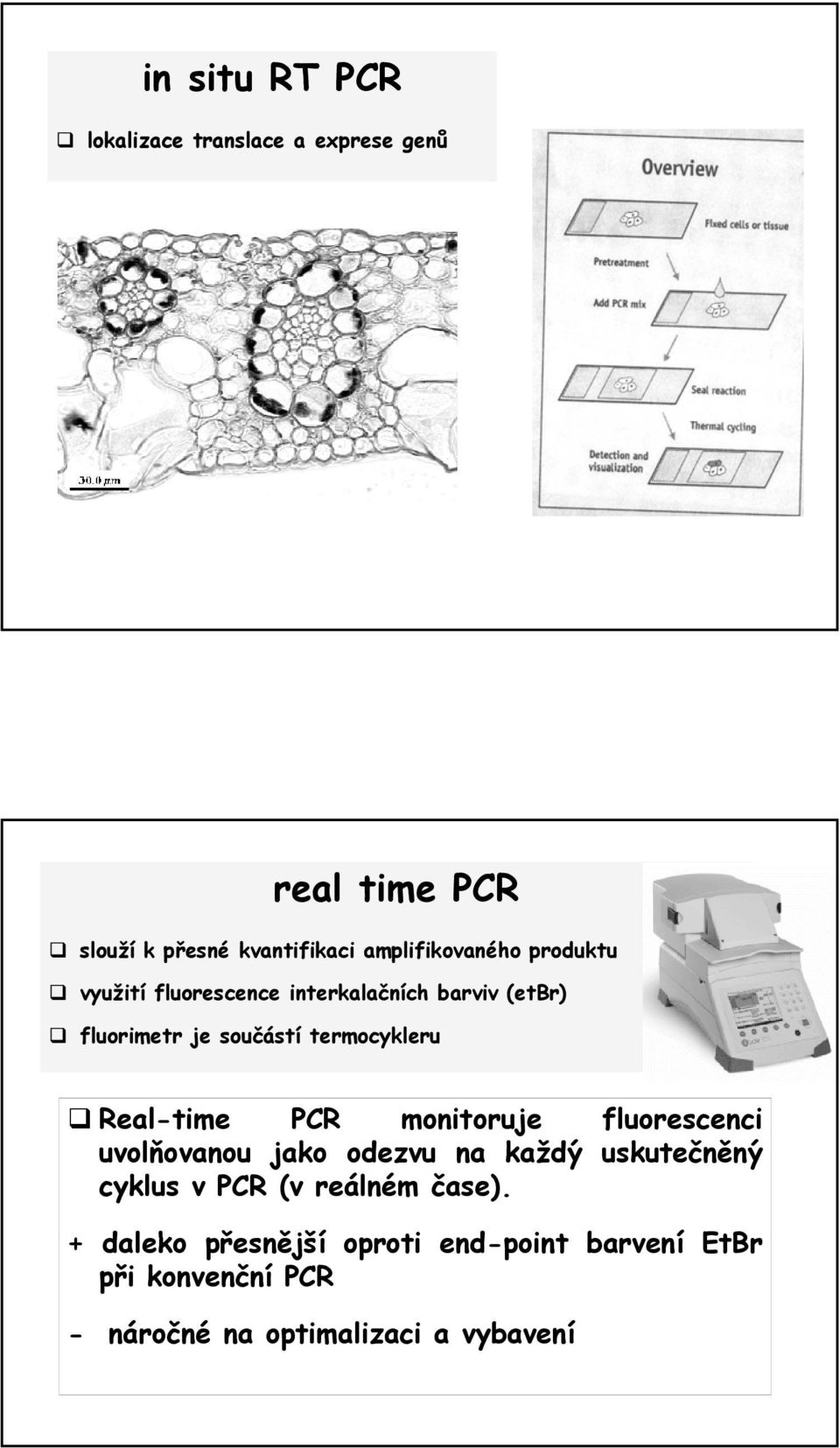 termocykleru Real-time PCR monitoruje fluorescenci uvolňovanou jako odezvu na každý uskutečněný cyklus v