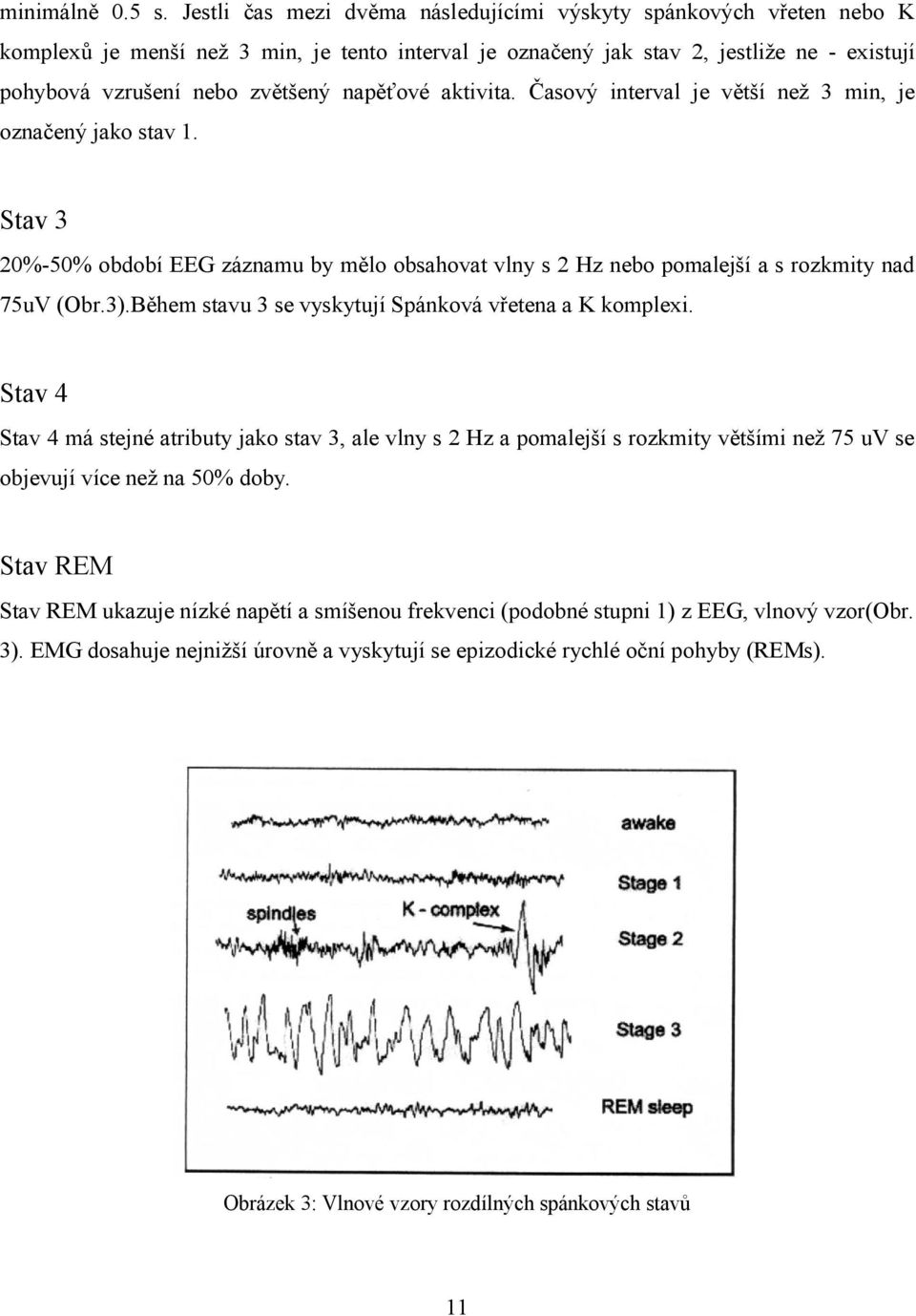 napěťové aktivita. Časový interval je větší než 3 min, je označený jako stav 1. Stav 3 20%-50% období EEG záznamu by mělo obsahovat vlny s 2 Hz nebo pomalejší a s rozkmity nad 75uV (Obr.3).