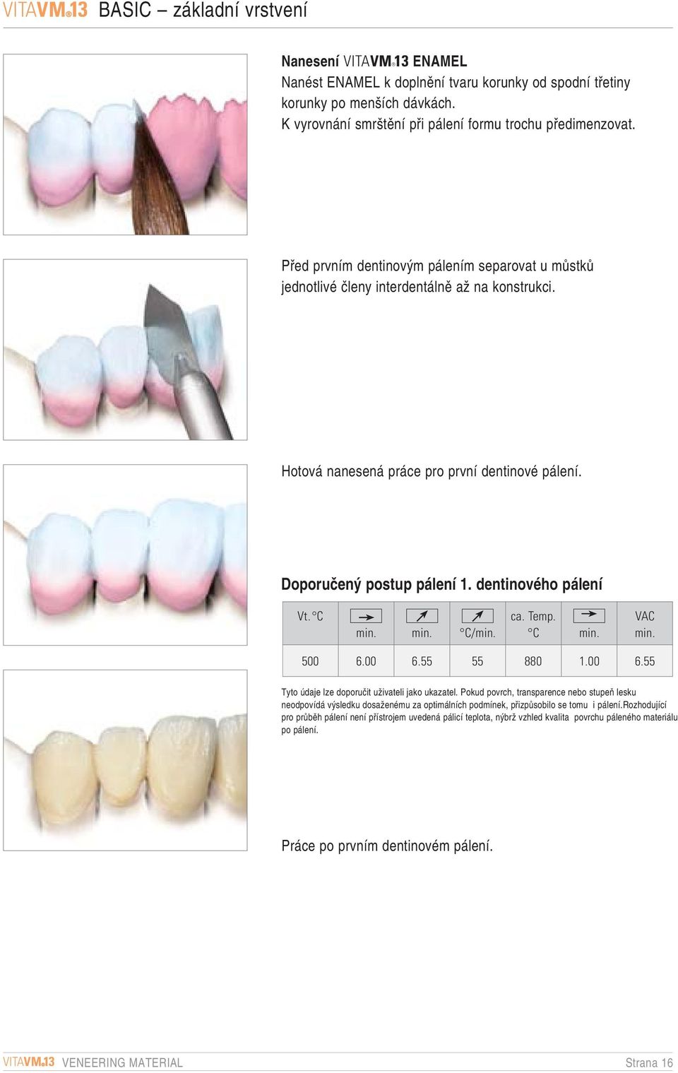 Hotová nanesená práce pro první dentinové pálení. Doporuãen postup pálení. dentinového pálení Vt. C C/ ca. Temp. C VAC 500 6.00 6.55 55 880.00 6.55 Tyto údaje lze doporuãit uïivateli jako ukazatel.