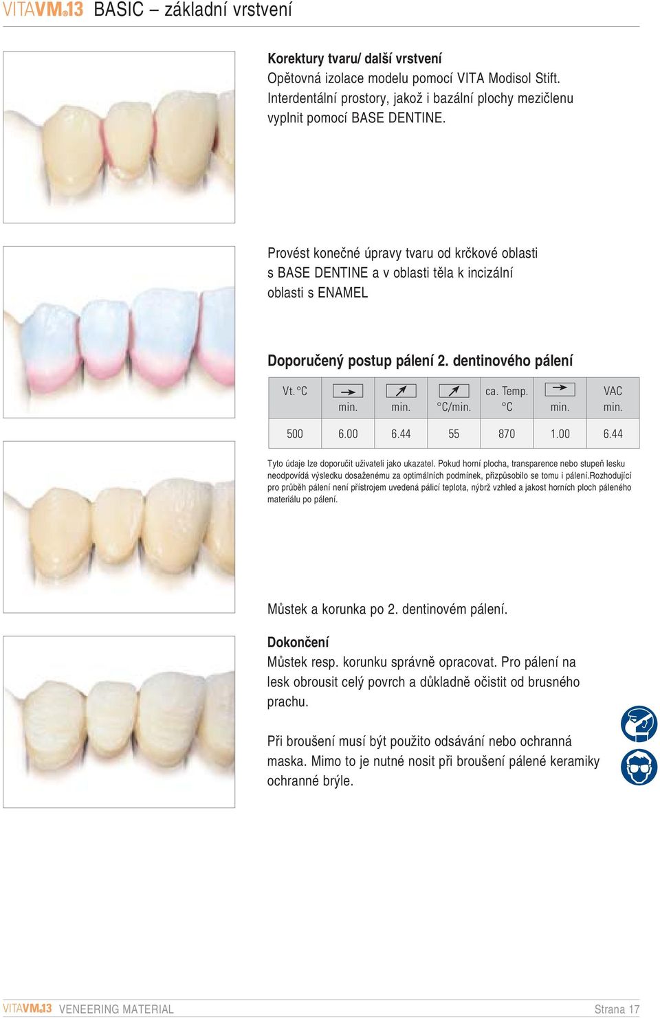 Provést koneãné úpravy tvaru od krãkové oblasti s BASE DENTINE a v oblasti tûla k incizální oblasti s ENAMEL Doporuãen postup pálení 2. dentinového pálení Vt. C C/ ca. Temp. C VAC 500 6.00 6.44 55 870.
