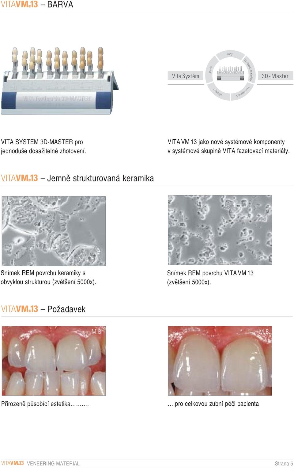 VITAVM 3 Jemnû strukturovaná keramika Snímek REM povrchu keramiky s obvyklou strukturou (zvût ení 5000x).