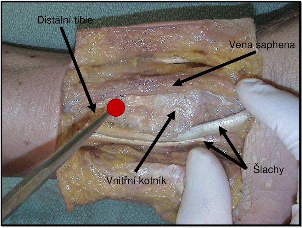 Vena saphena