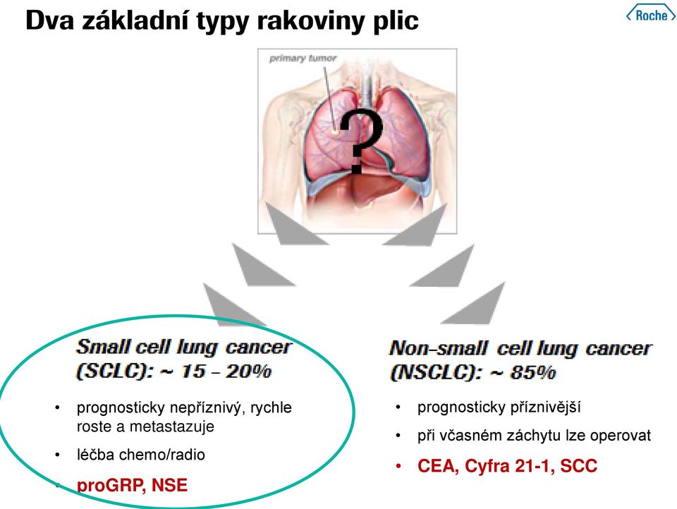 chemo/radio progrp, NSE prognosticky