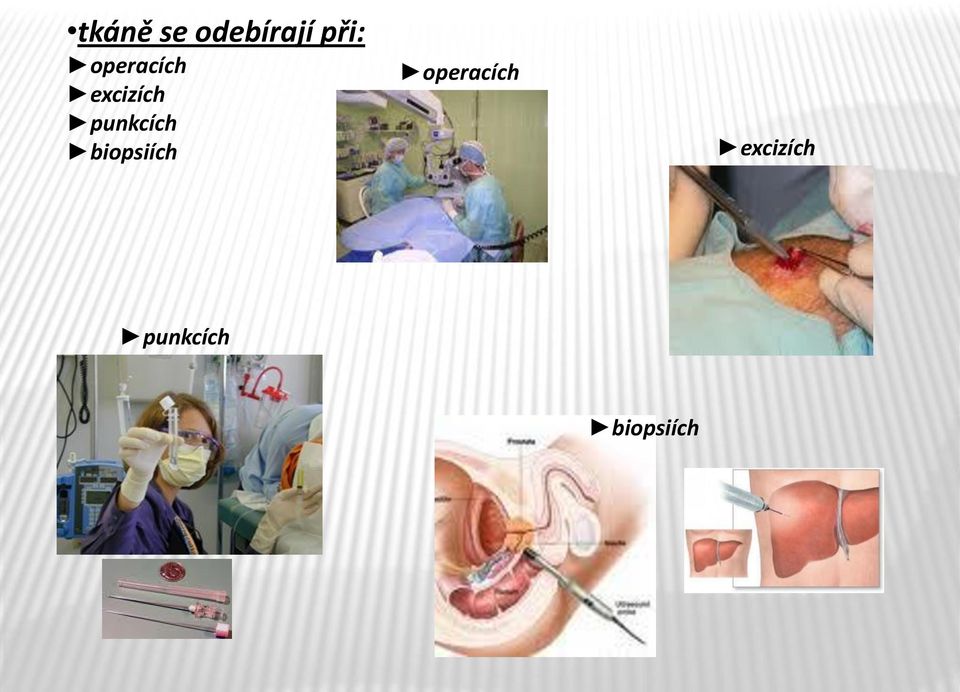 punkcích biopsiích 