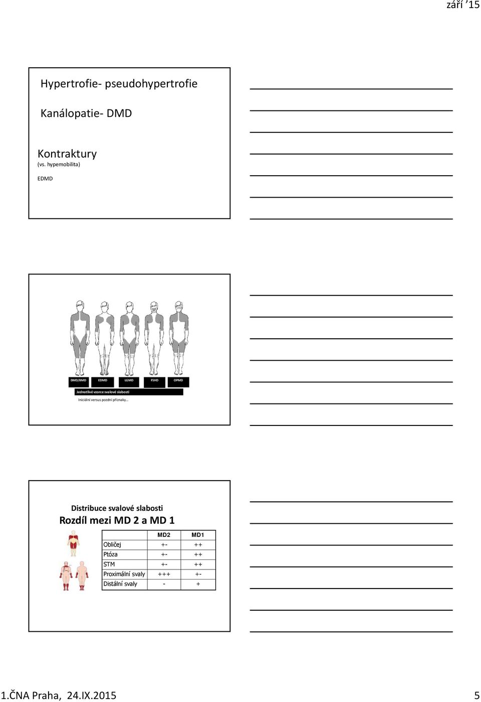 Iniciální versus pozdní příznaky Distribuce svalové slabosti Rozdíl mezi MD 2 a MD 1
