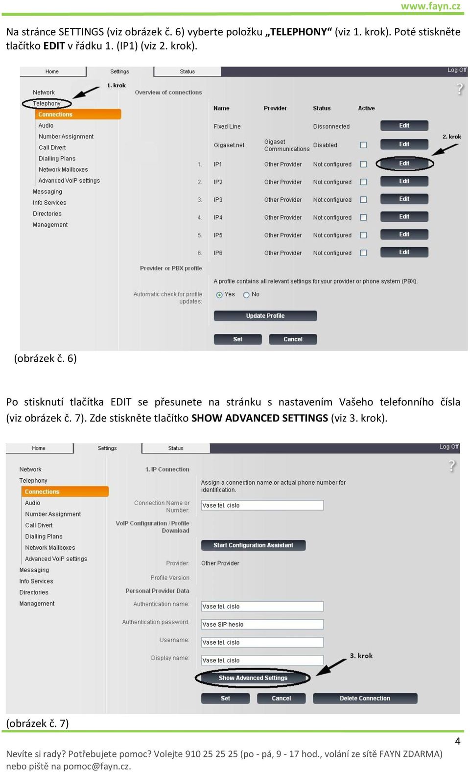 6) Po stisknutí tlačítka EDIT se přesunete na stránku s nastavením Vašeho telefonního