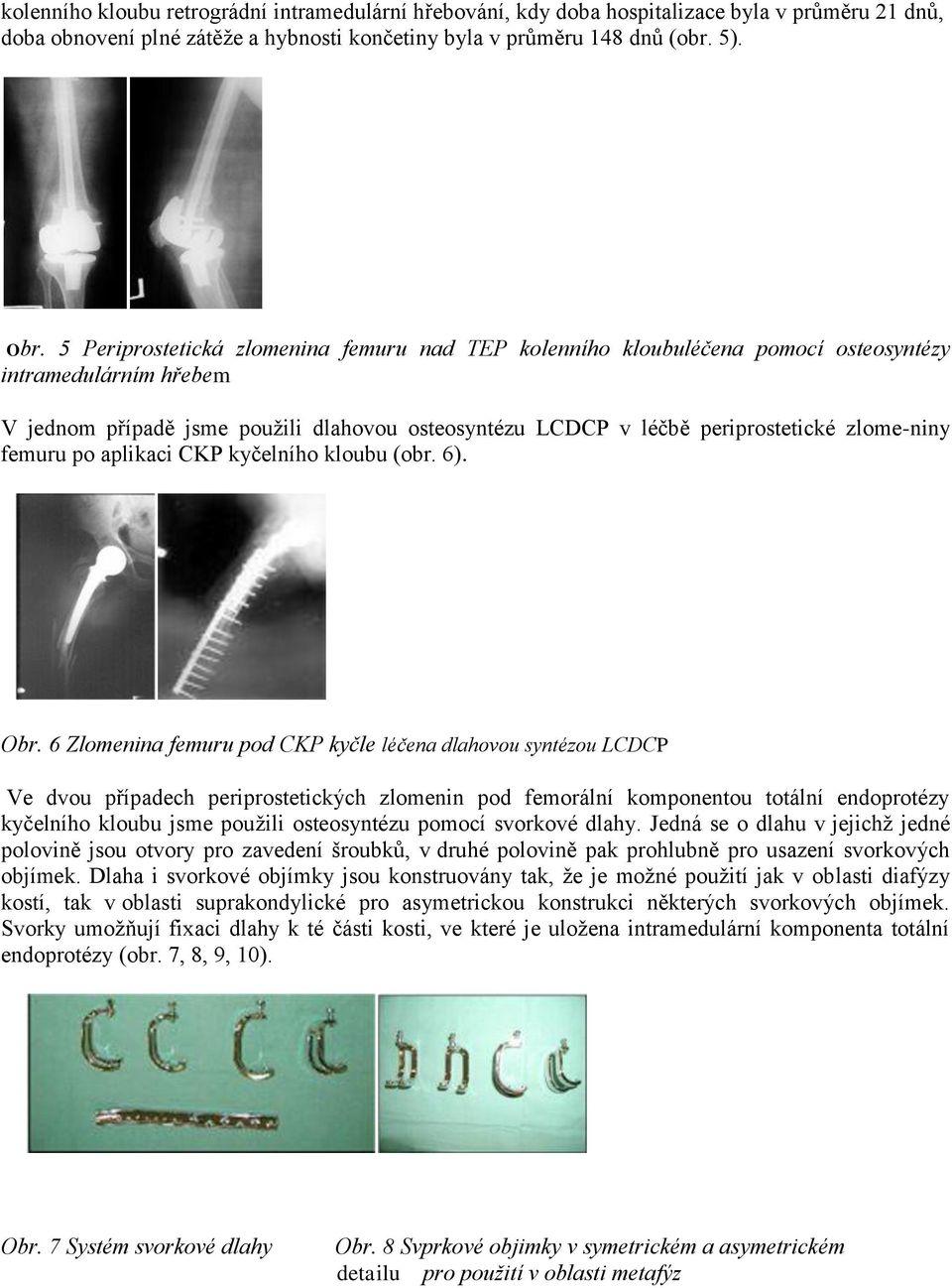 zlome-niny femuru po aplikaci CKP kyčelního kloubu (obr. 6). Obr.