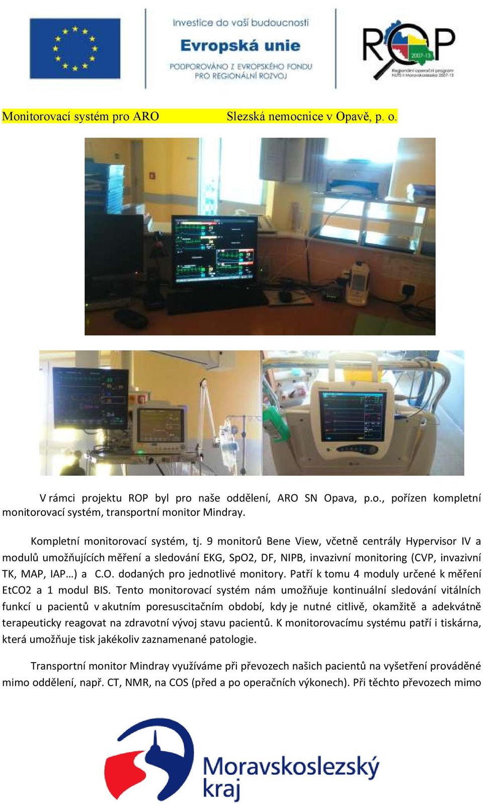 9 monitorů Bene View, včetně centrály Hypervisor IV a modulů umožňujících měření a sledování EKG, SpO2, DF, NIPB, invazivní monitoring (CVP, invazivní TK, MAP, IAP ) a C.O. dodaných pro jednotlivé monitory.