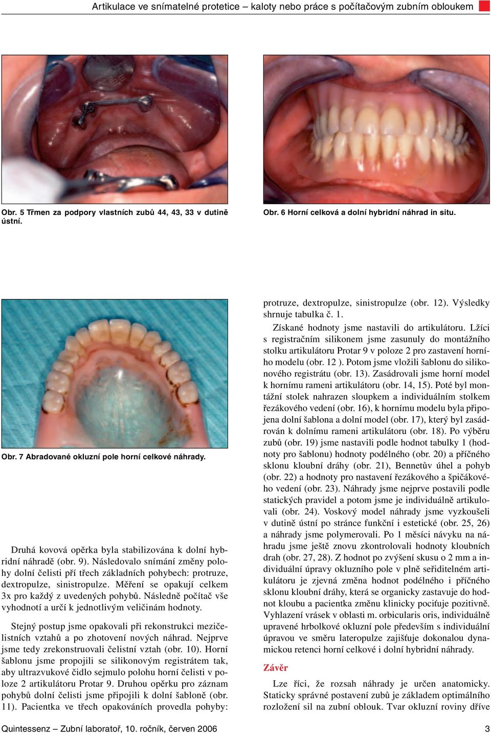 Artikulace ve snímatelné protetice kaloty nebo práce s počítačovým zubním  obloukem - PDF Free Download