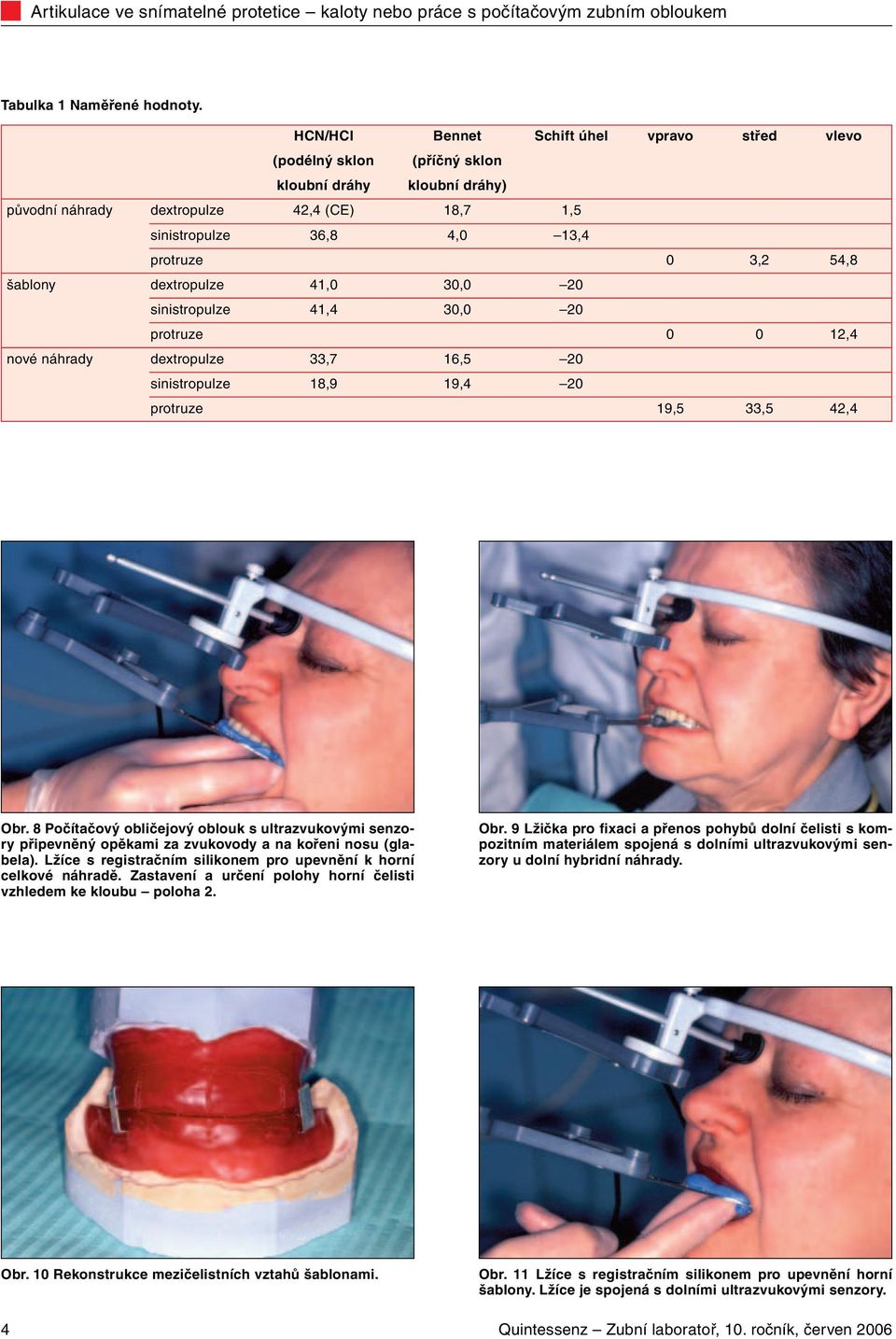 šablony dextropulze 41,0 30,0 20 sinistropulze 41,4 30,0 20 protruze 0 0 12,4 nové náhrady dextropulze 33,7 16,5 20 sinistropulze 18,9 19,4 20 protruze 19,5 33,5 42,4 Obr.