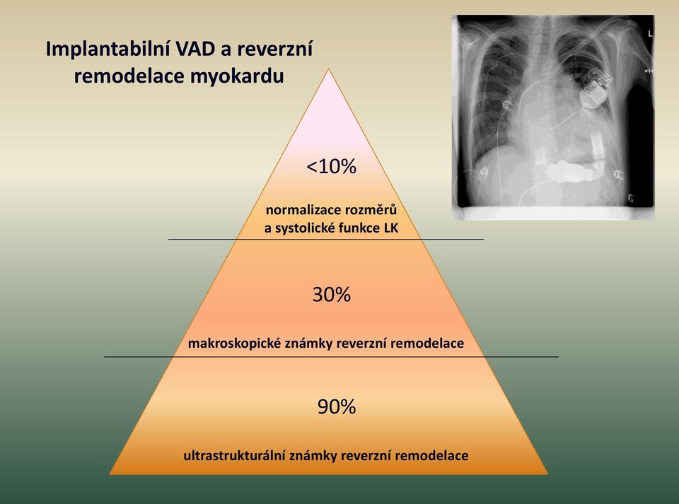 funkce LK 30% makroskopické známky reverzní