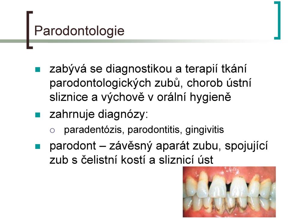 hygieně zahrnuje diagnózy: paradentózis, parodontitis, gingivitis