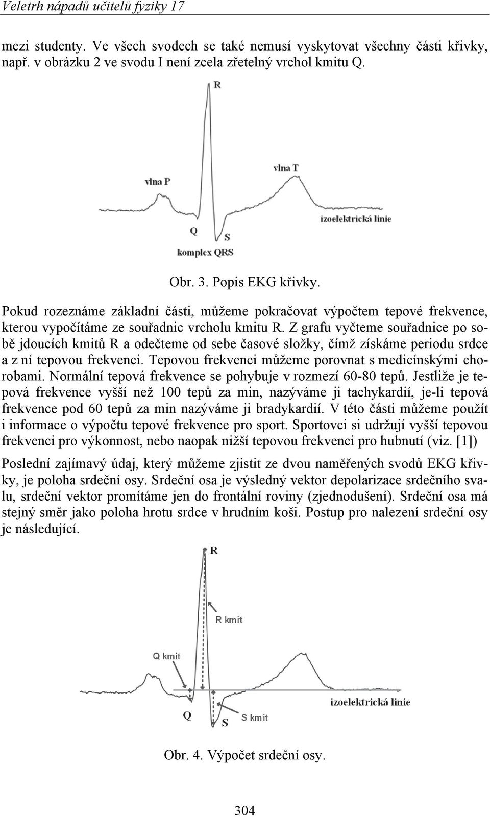 Z grafu vyčteme souřadnice po sobě jdoucích kmitů R a odečteme od sebe časové složky, čímž získáme periodu srdce a z ní tepovou frekvenci. Tepovou frekvenci můžeme porovnat s medicínskými chorobami.