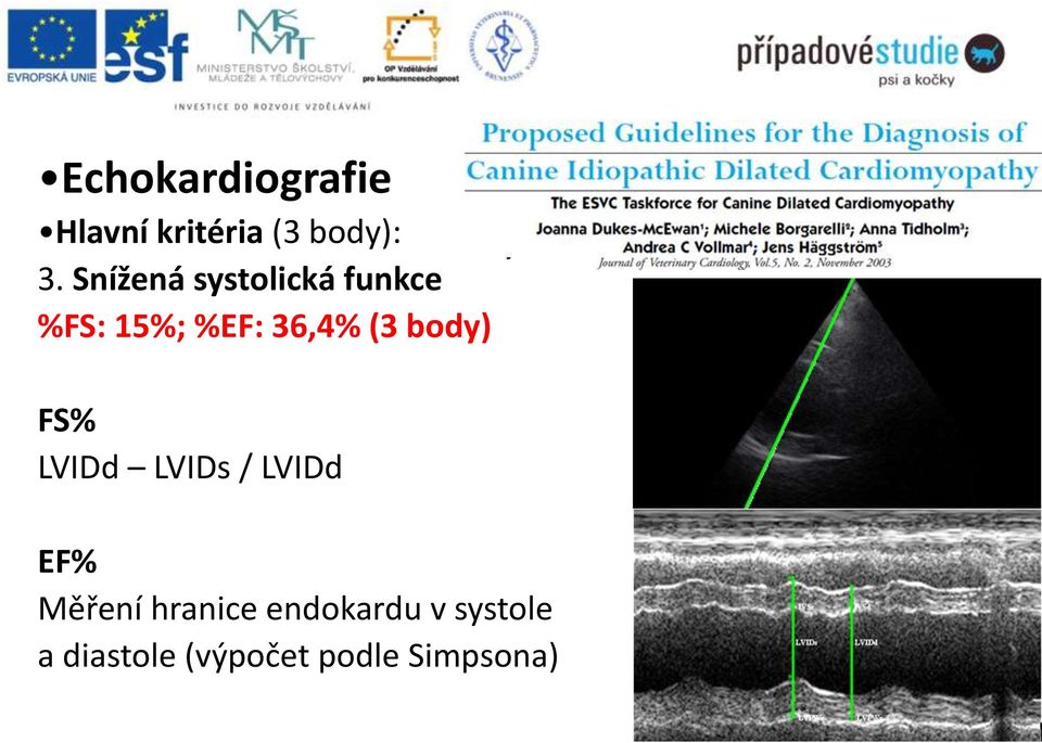 body) FS% LVIDd LVIDs / LVIDd EF% Měření hranice