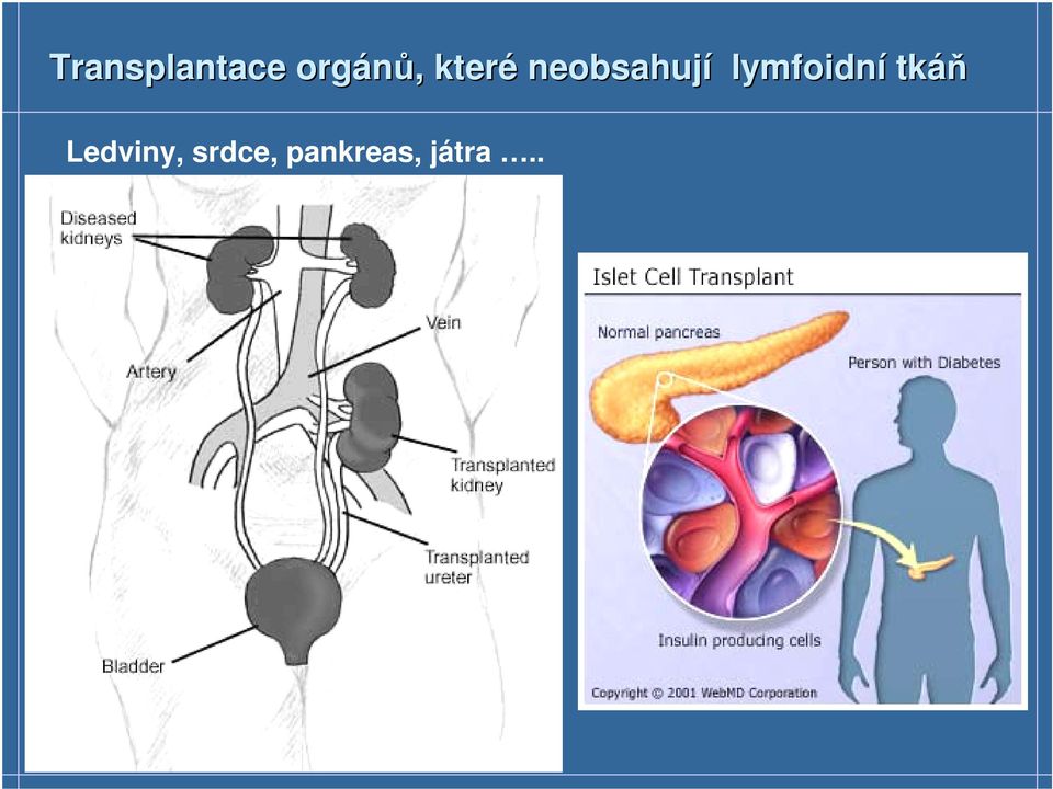 neobsahují lymfoidní