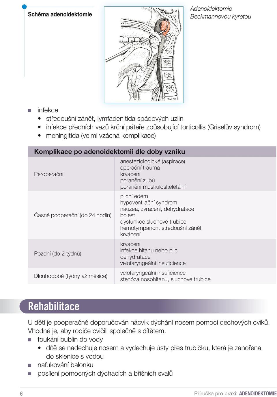 (aspirace) operační trauma krvácení poranění zubů poranění muskuloskeletální plicní edém hypoventilační syndrom nauzea, zvracení, dehydratace bolest dysfunkce sluchové trubice hemotympanon,