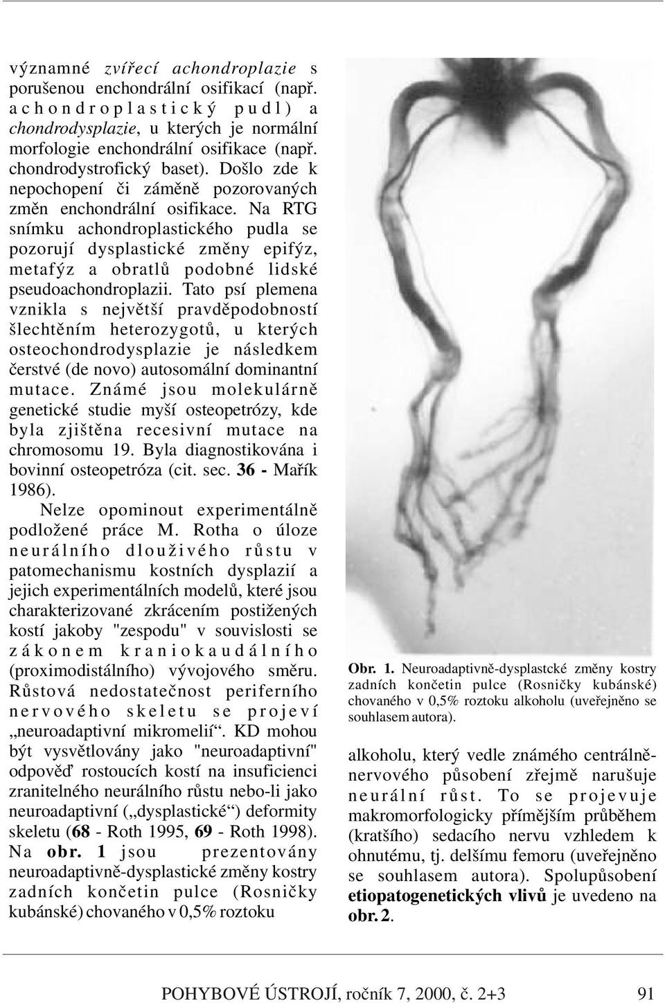 Na RTG snímku achondroplastického pudla se pozorují dysplastické změny epifýz, metafýz a obratlů podobné lidské pseudoachondroplazii.
