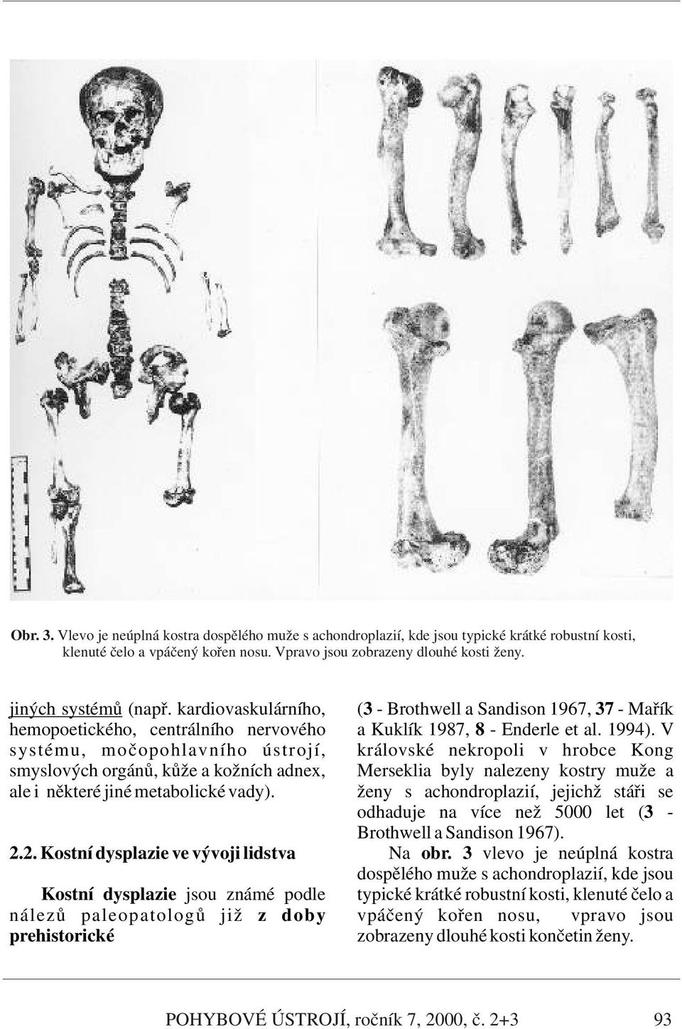 V systému, močopohlavního ústrojí, královské nekropoli v hrobce Kong smyslových orgánů, kůže a kožních adnex, Merseklia byly nalezeny kostry muže a ale i některé jiné metabolické vady).