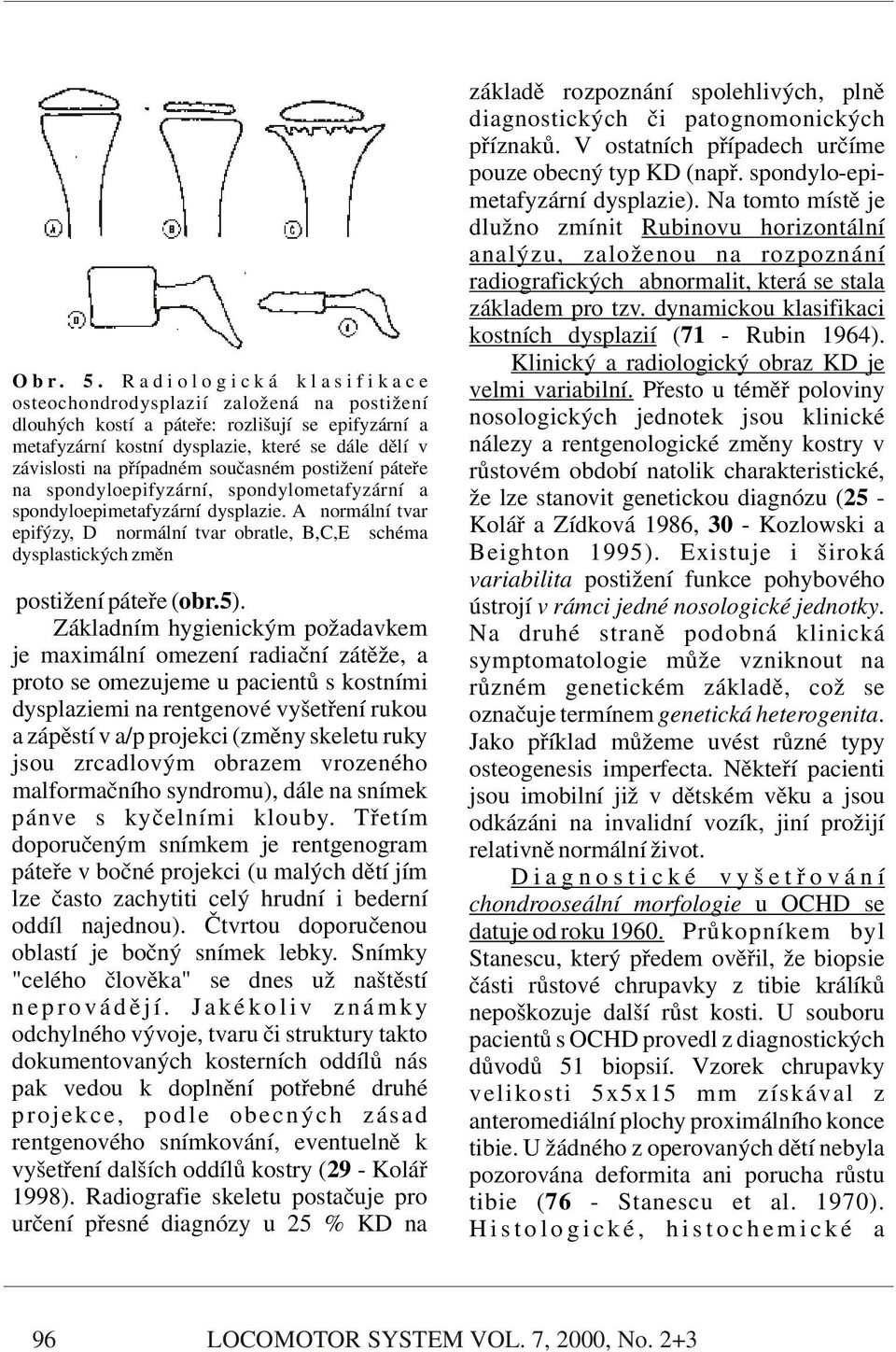 dynamickou klasifikaci kostních dysplazií (71 - Rubin 1964). Klinický a radiologický obraz KD je O b r. 5. R a d i o l o g i c k á k l a s i f i k a c e velmi variabilní.