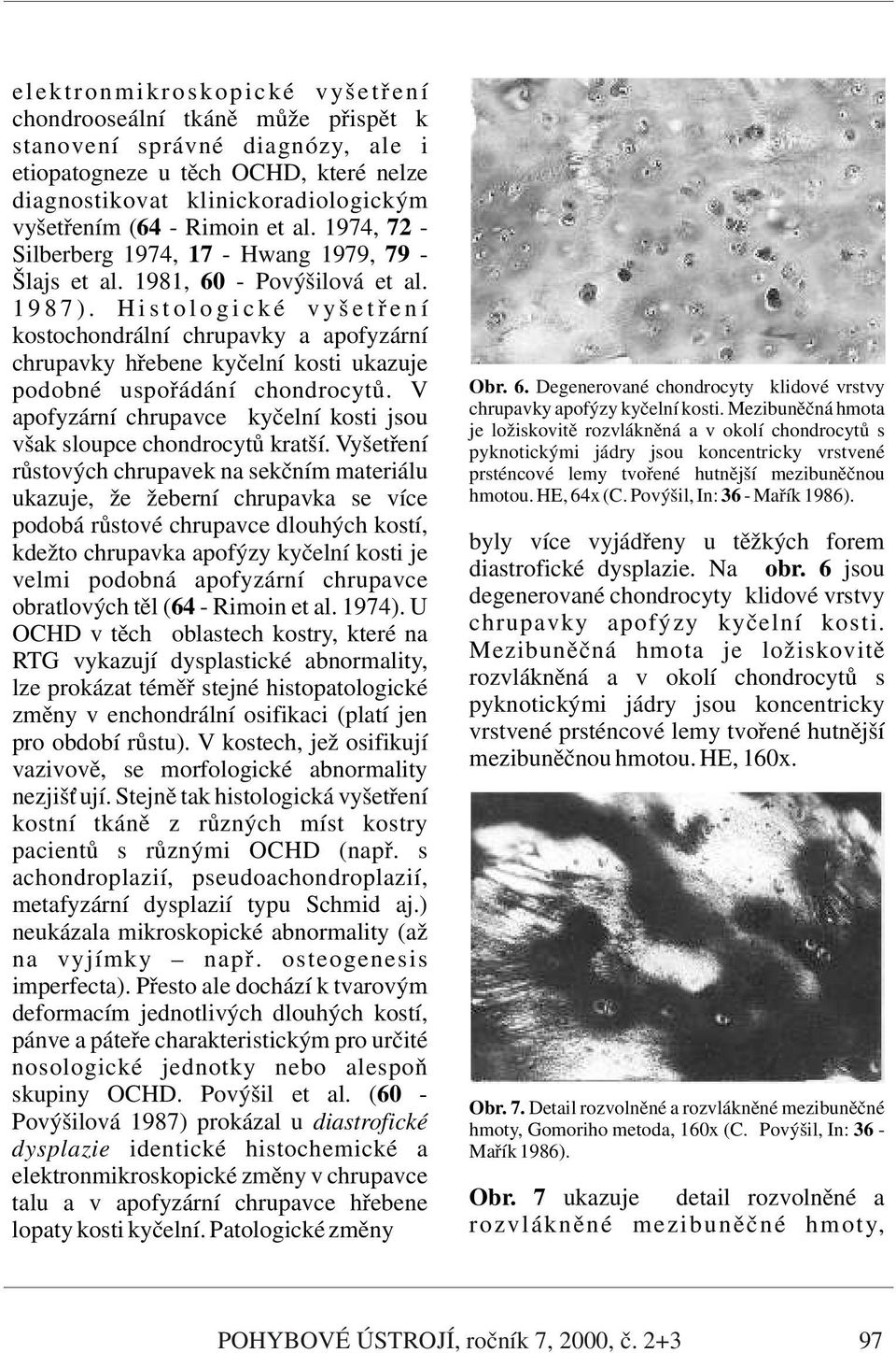 H i s t o l o g i c k é v y š e t ř e n í kostochondrální chrupavky a apofyzární chrupavky hřebene kyčelní kosti ukazuje podobné uspořádání chondrocytů.