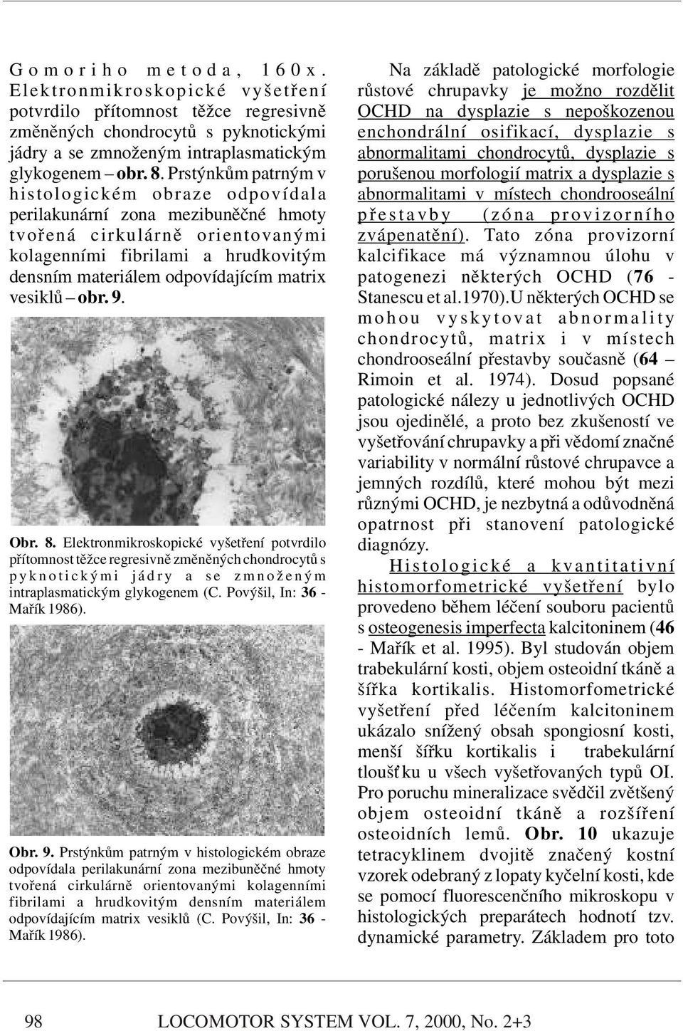 pyknotickými enchondrální osifikací, dysplazie s jádry a se zmnoženým intraplasmatickým abnormalitami chondrocytů, dysplazie s glykogenem obr. 8.