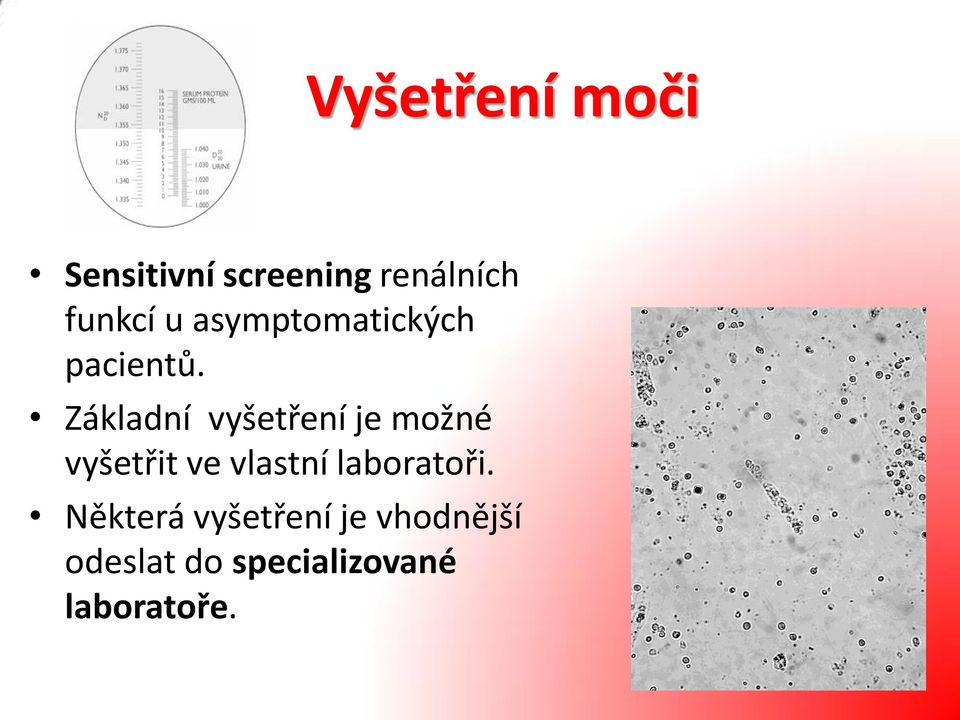 Základní vyšetření je možné vyšetřit ve vlastní