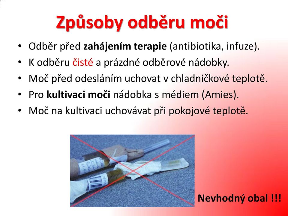 Moč před odesláním uchovat v chladničkové teplotě.