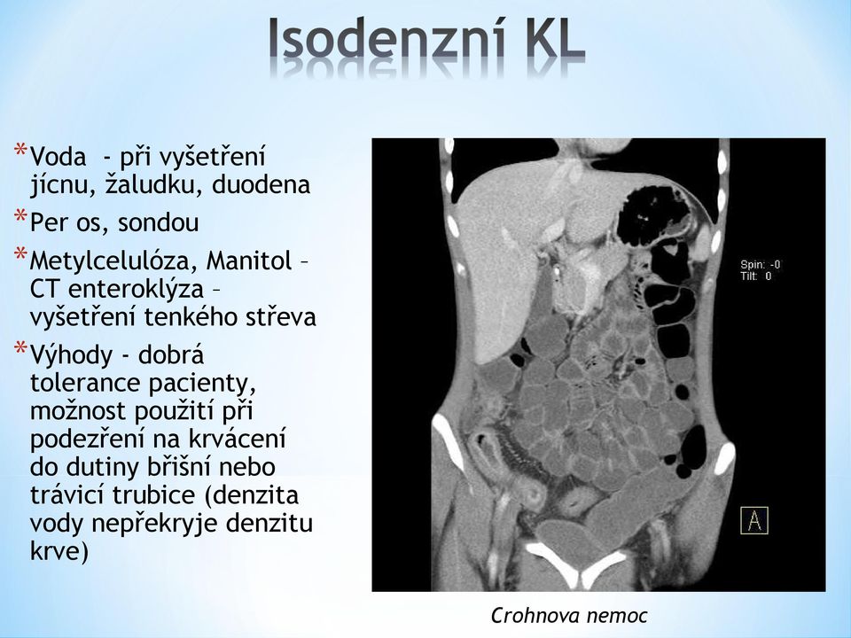 dobrá tolerance pacienty, možnost použití při podezření na krvácení do