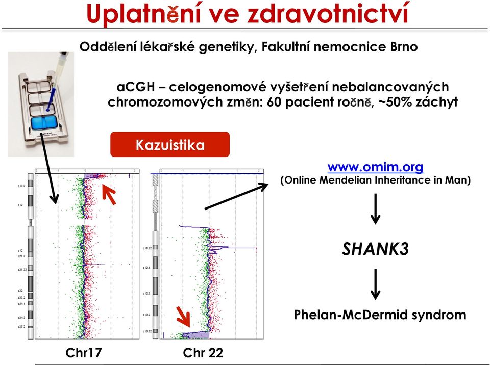 chromozomových změn: 60 pacient ročně, ~50% záchyt Kazuistika www.