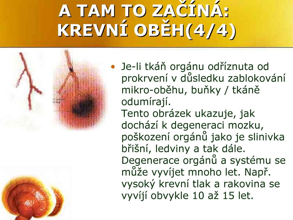 Tento obrázek ukazuje, jak dochází k degeneraci mozku, poškození orgánů jako je slinivka