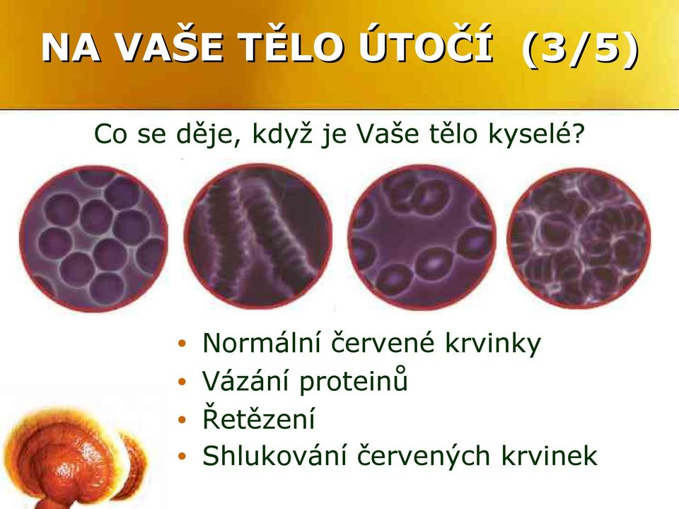 Normální červené krvinky Vázání