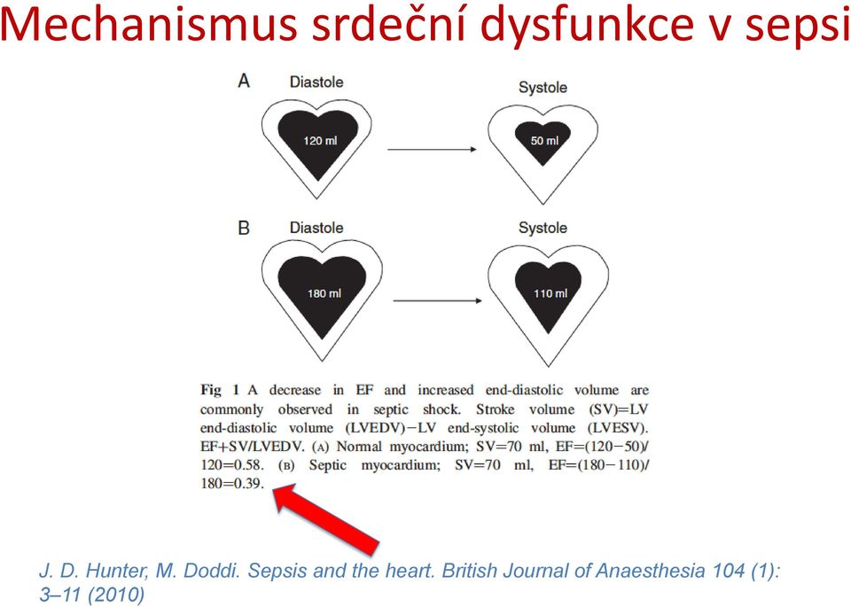 Sepsis and the heart.