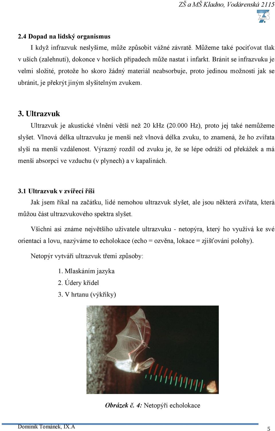 Ultrazvuk Ultrazvuk je akustické vlnění větší než 20 khz (20.000 Hz), proto jej také nemůžeme slyšet.