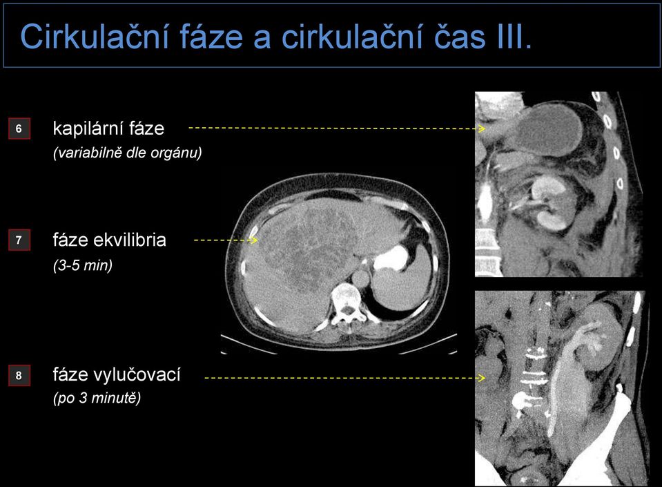 dle orgánu) 7 fáze ekvilibria (3-5