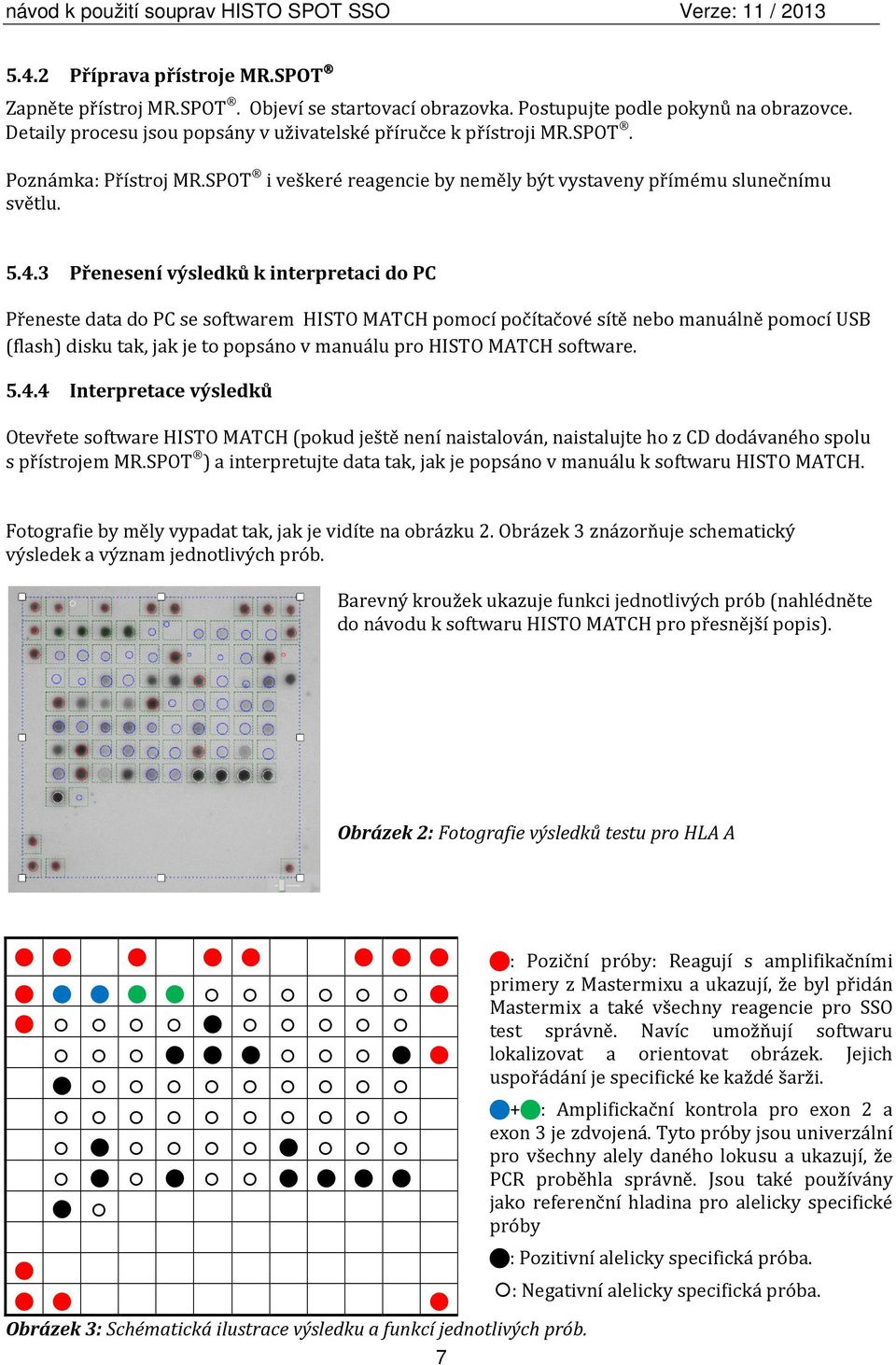 3 Přenesení výsledků k interpretaci do PC Přeneste data do PC se softwarem HISTO MATCH pomocí počítačové sítě nebo manuálně pomocí USB (flash) disku tak, jak je to popsáno v manuálu pro HISTO MATCH