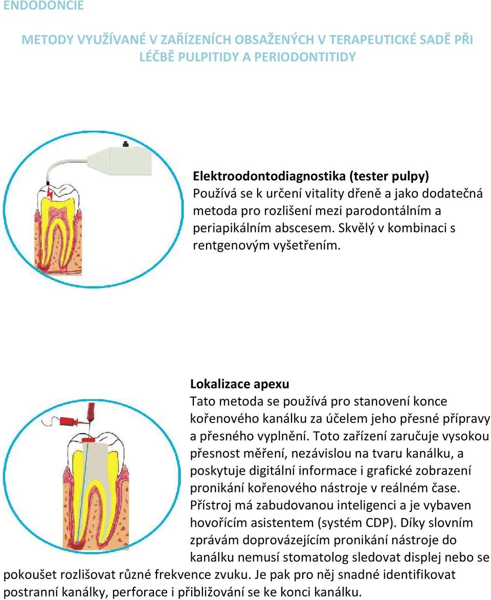 Lokalizace apexu Tato metoda se používá pro stanovení konce kořenového kanálku za účelem jeho přesné přípravy a přesného vyplnění.