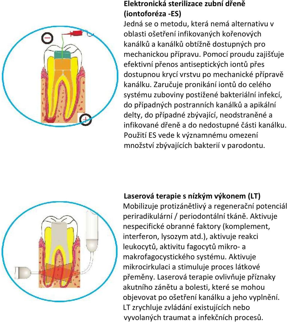 Zaručuje pronikání iontů do celého systému zuboviny postižené bakteriální infekcí, do případných postranních kanálků a apikální delty, do případné zbývající, neodstraněné a infikované dřeně a do