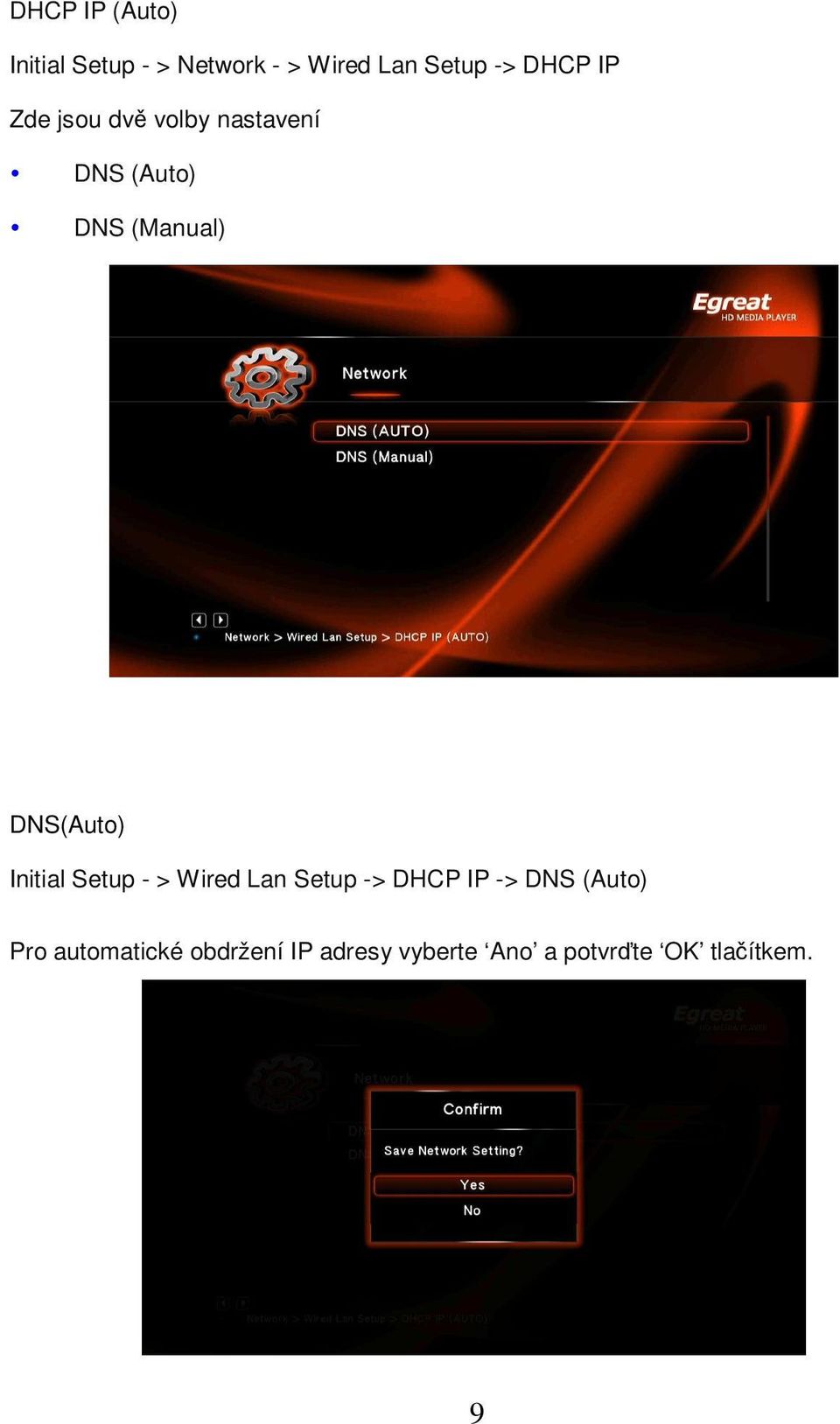DNS(Auto) Initial Setup - > Wired Lan Setup -> DHCP IP -> DNS