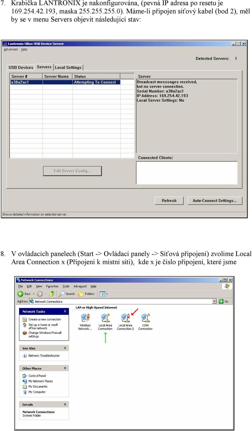 Máme-li připojen síťový kabel (bod 2), měl by se v menu Servers objevit následující stav: 8.