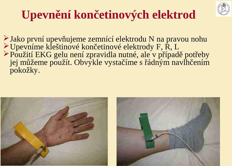 elektrody F, R, L Použití EKG gelu není zpravidla nutné, ale v