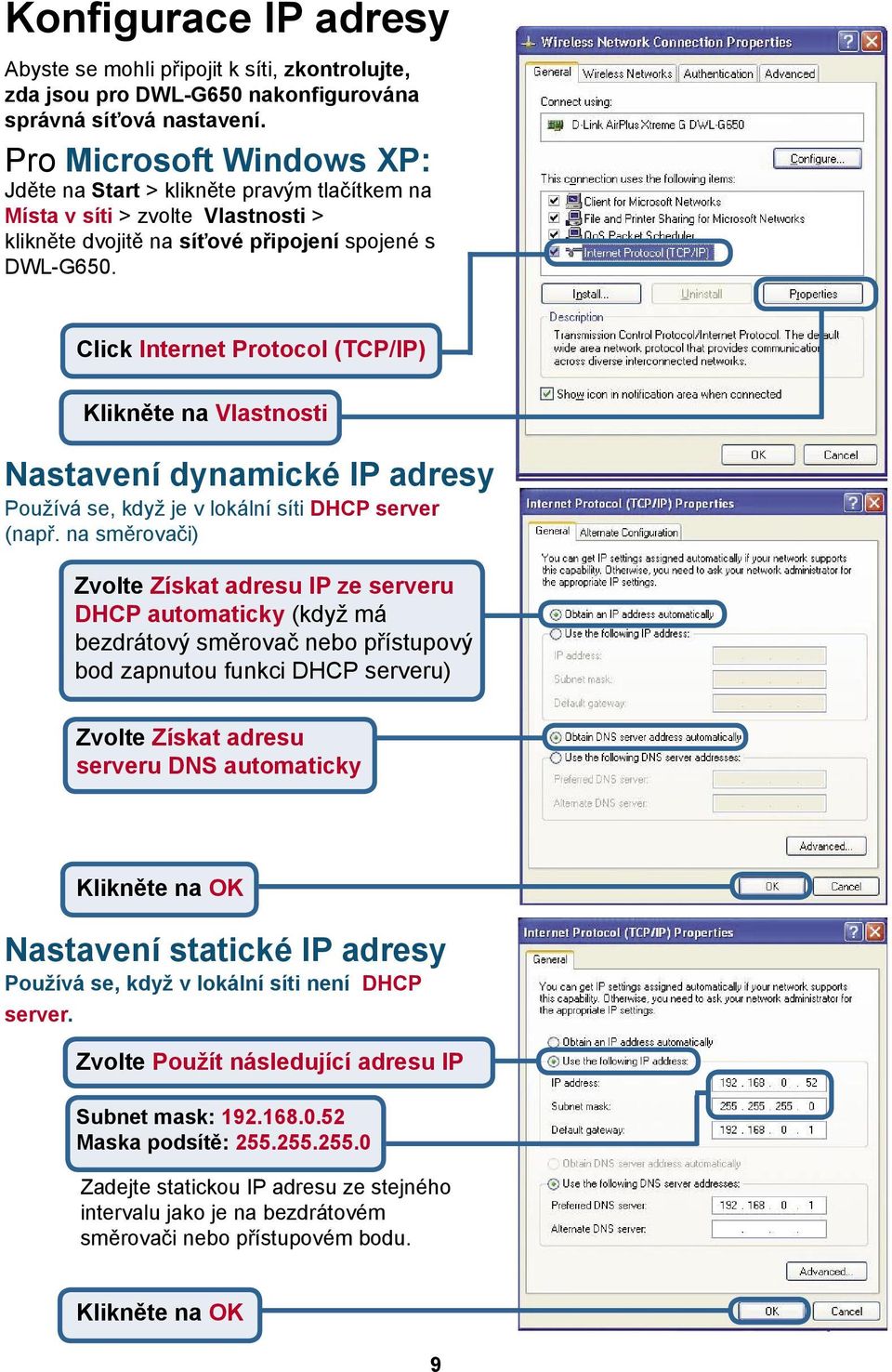 Click Internet Protocol (TCP/IP) Klikněte na Vlastnosti Nastavení dynamické IP adresy Používá se, když je v lokální síti DHCP server (např.