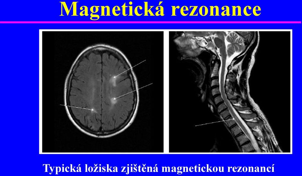 Typická ložiska